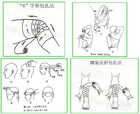 常用包扎方法.jpg